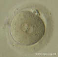 Чезез 16-18 часов после оплодотворения in vitro (добавления сперматозоидов к ооцитам - ЭКО или инъекции сперматозоида в ооцит - ИКСИ) можно наблюдать стадию презиготы - ооцит с двумя пронуклеусами (мужским и женским), генетический материал которых пока еще не слился. В условиях in vivo оплодотворение происходит в ампулярном отделе маточной трубы